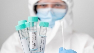pemerintah akan menanggung biaya pemeriksaan swab Polymerase Chain Reaction (PCR) untuk CJH